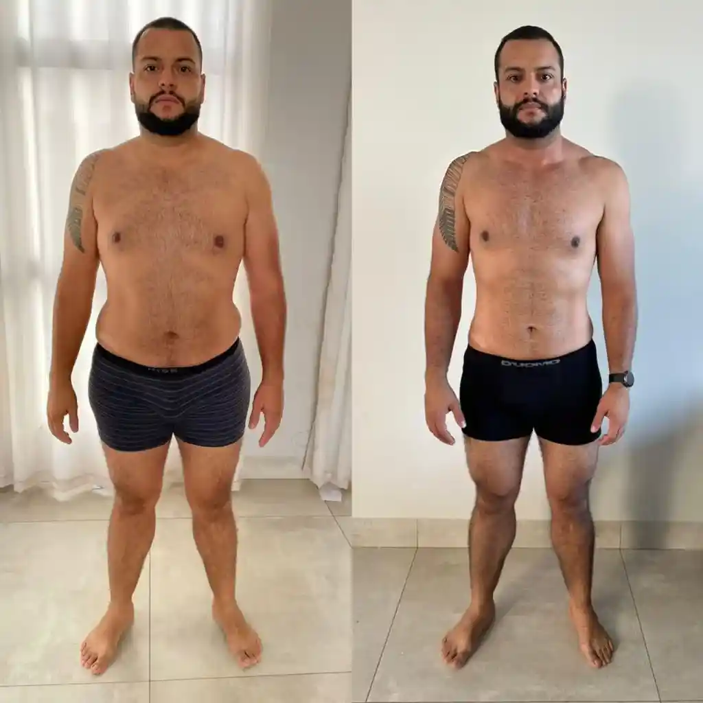 ANTES E DEPOIS 3